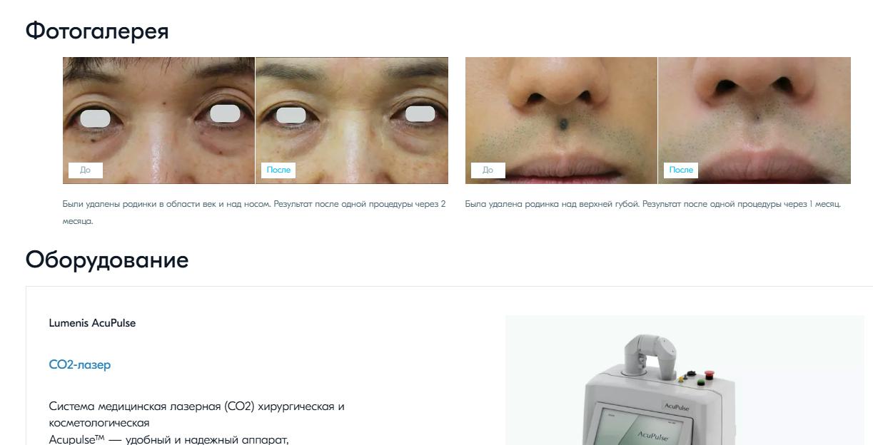 оптимизация сайта